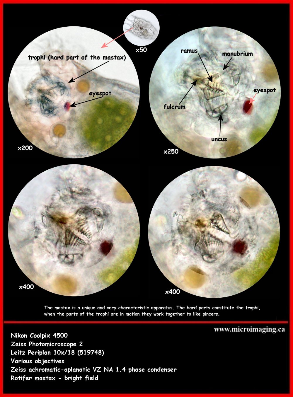 Rotifer trophi