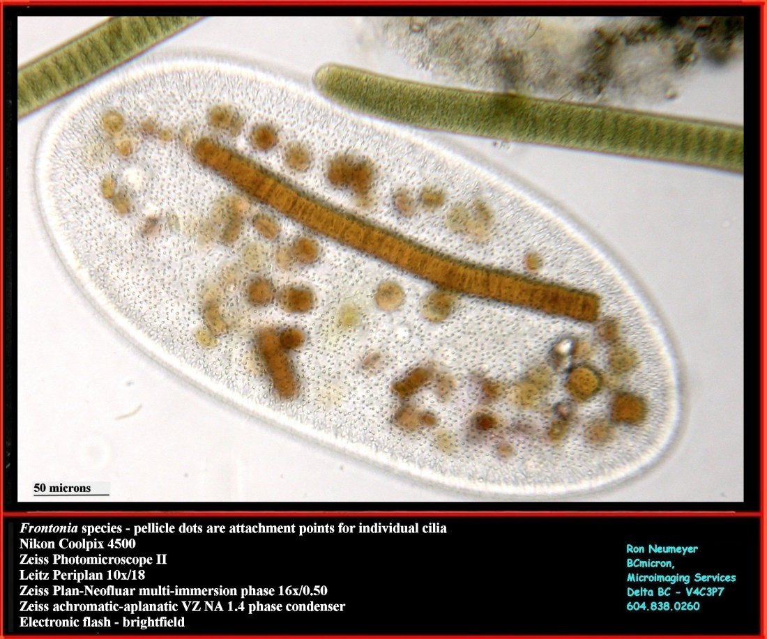 Frontonia sp. - pellicle